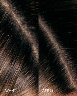 Huile Remède Cuir Chevelu Aceite De Moska 11 Huile Remède Cuir Chevelu Aceite De Moska -Meilleur Cosmétiques Magasin AvantapresCeremonia AceitedeMoska